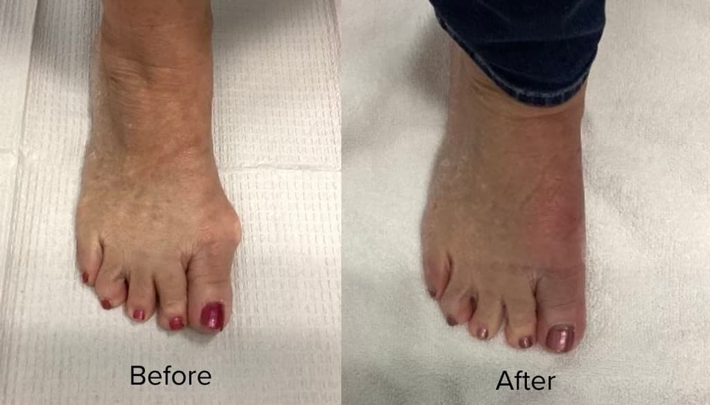 before and after photos
